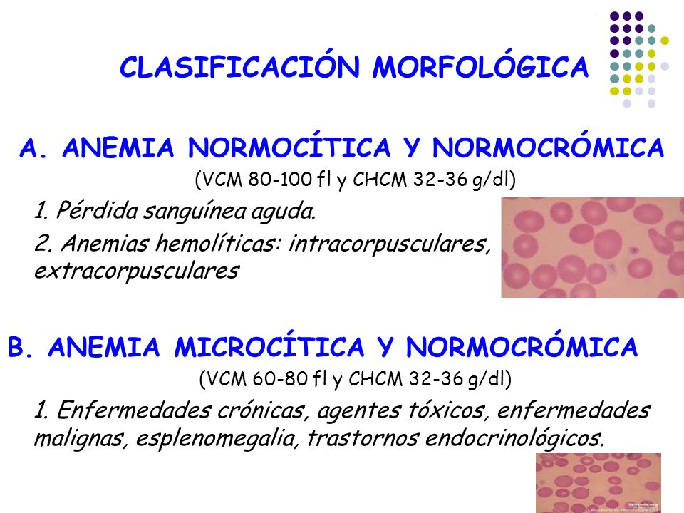 anemia normocitica normocromica